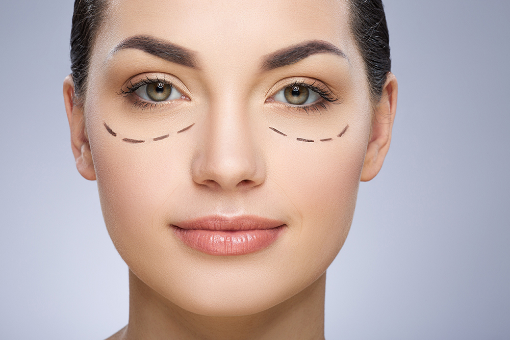 Am I a Candidate for Eyelid Surgery?