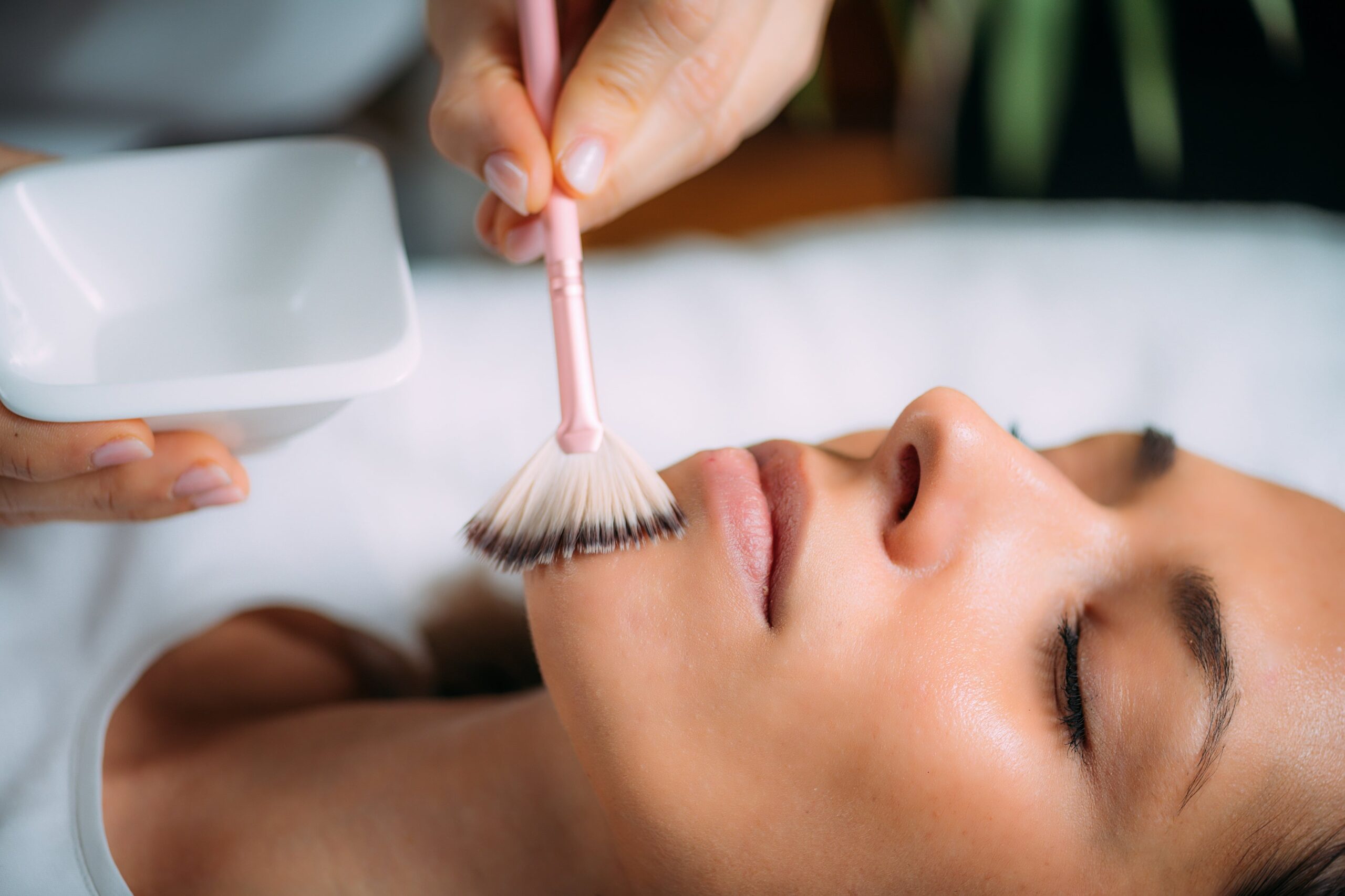 What Can You Expect After a Chemical Peel?
