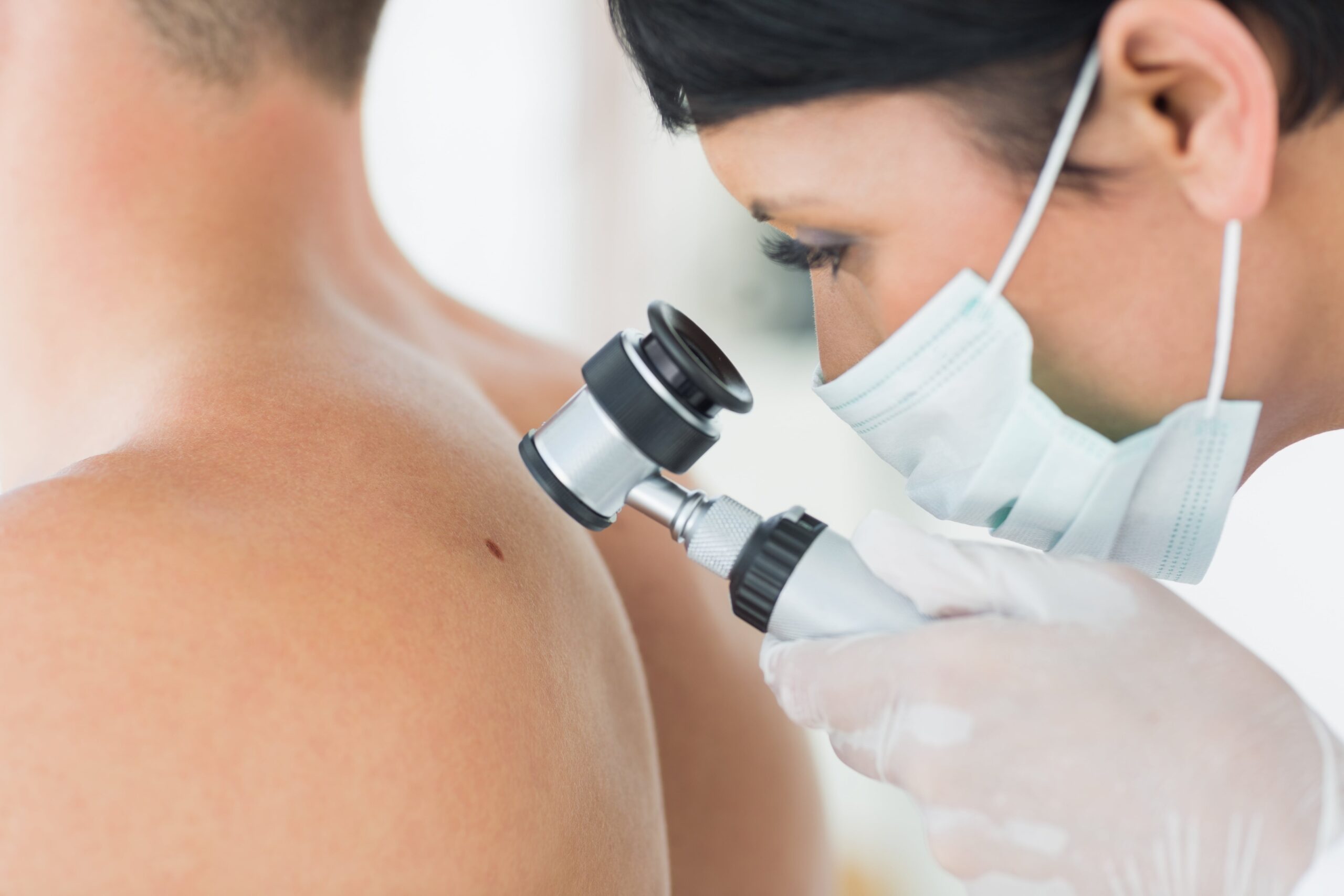 Skin Cancer, sun avoidance